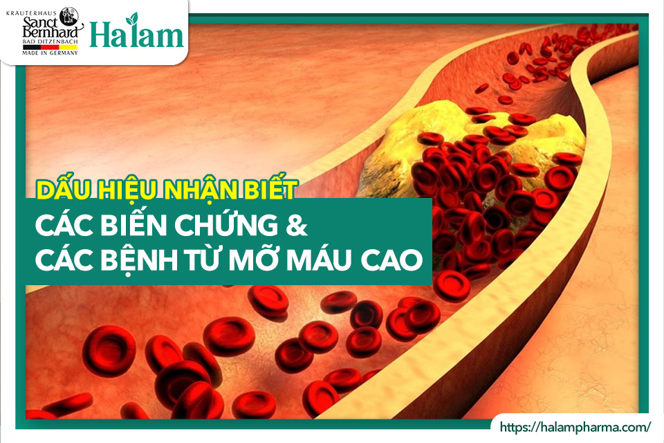 DẤU HIỆU & BIẾN CHỨNG TỪ MỠ MÁU CAO