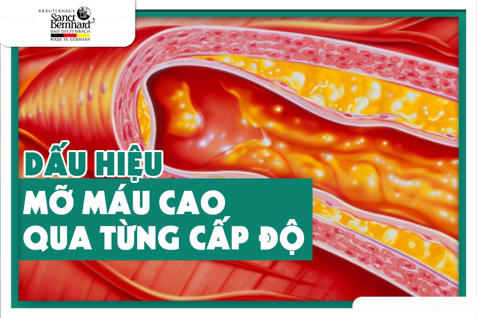 NHỮNG DẤU HIỆU CỦA BỆNH MỠ MÁU CAO QUA TỪNG CẤP ĐỘ